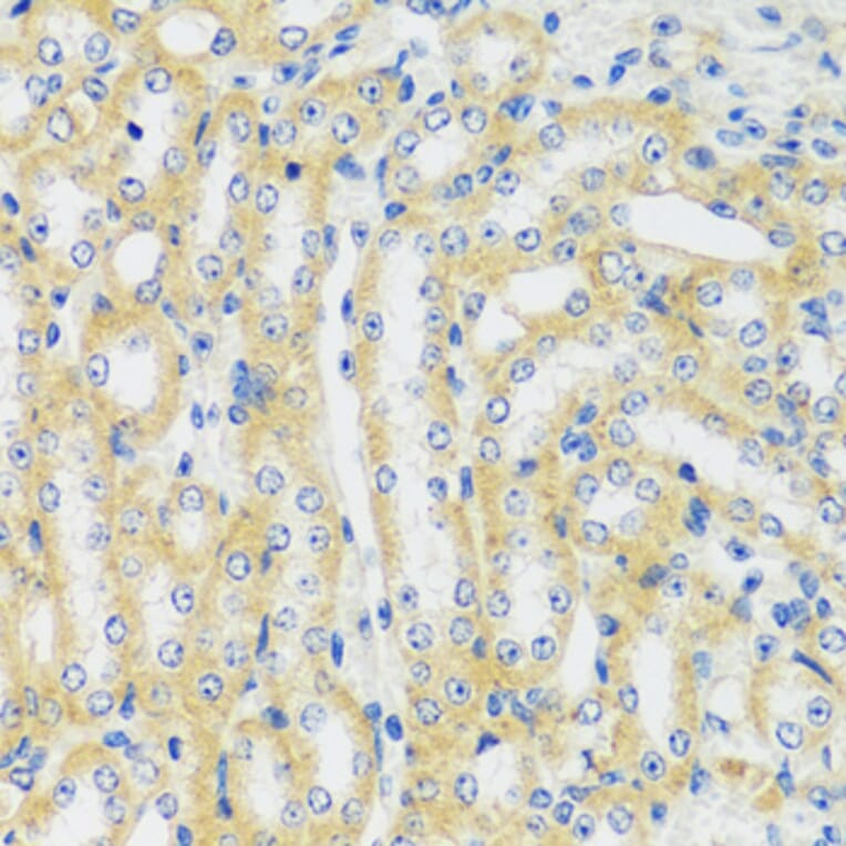 Immunohistochemistry - Anti-CaMKI Antibody (A89786) - Antibodies.com