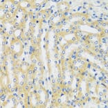 Immunohistochemistry - Anti-CaMKI Antibody (A89786) - Antibodies.com