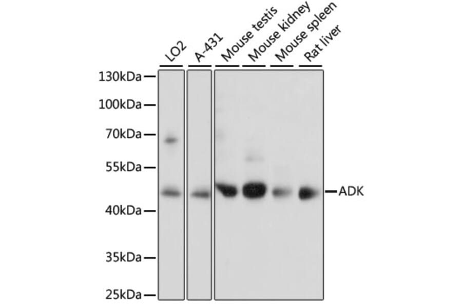 Western Blot - Anti-ADK Antibody (A89787) - Antibodies.com