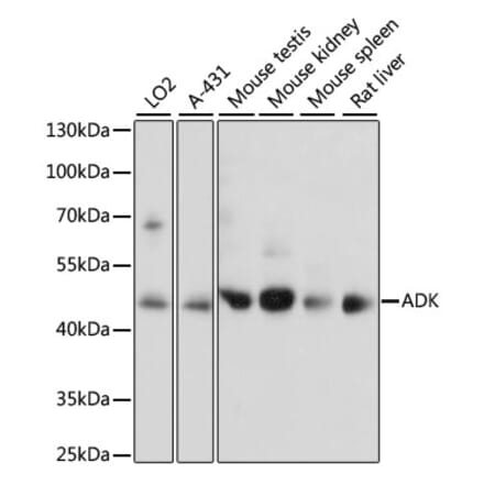 Western Blot - Anti-ADK Antibody (A89787) - Antibodies.com