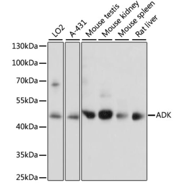 Western Blot - Anti-ADK Antibody (A89787) - Antibodies.com