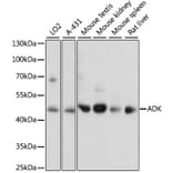 Western Blot - Anti-ADK Antibody (A89787) - Antibodies.com