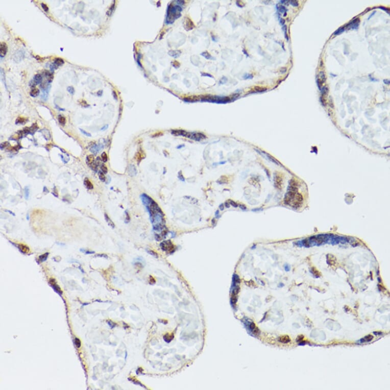 Immunohistochemistry - Anti-ADK Antibody (A89787) - Antibodies.com