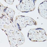 Immunohistochemistry - Anti-ADK Antibody (A89787) - Antibodies.com