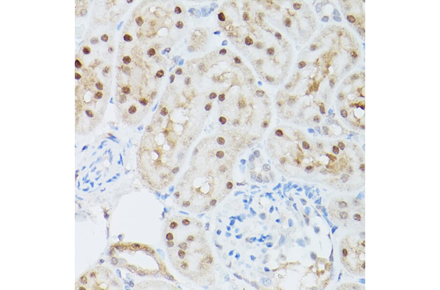 Immunohistochemistry - Anti-ADK Antibody (A89787) - Antibodies.com