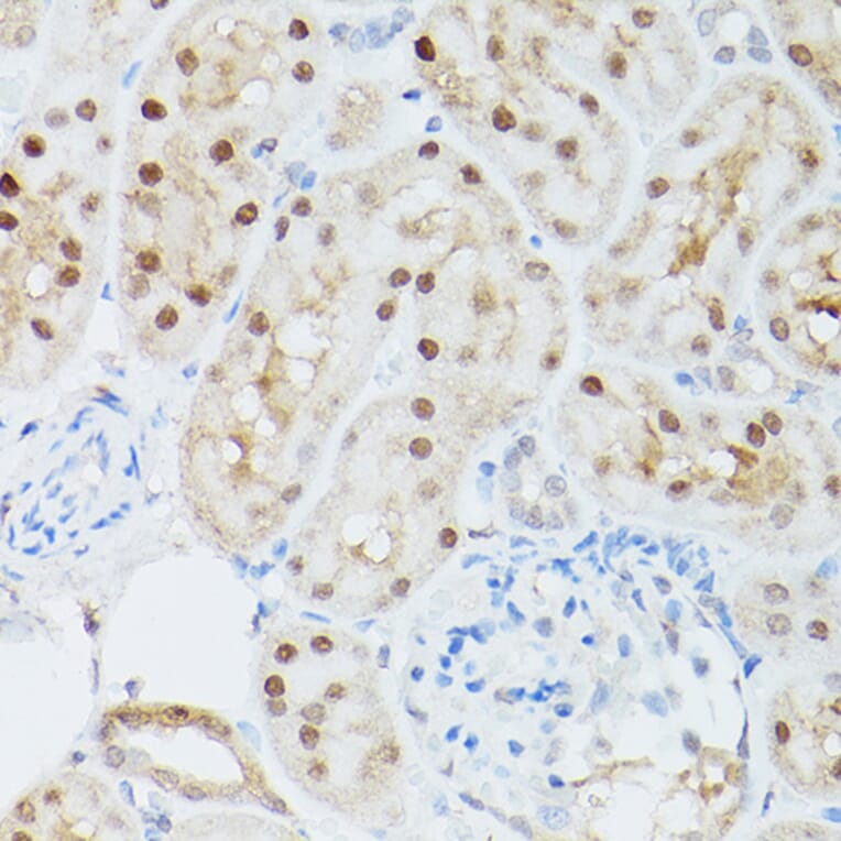Immunohistochemistry - Anti-ADK Antibody (A89787) - Antibodies.com