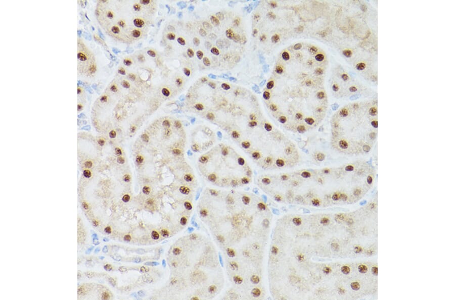 Immunohistochemistry - Anti-ADK Antibody (A89787) - Antibodies.com