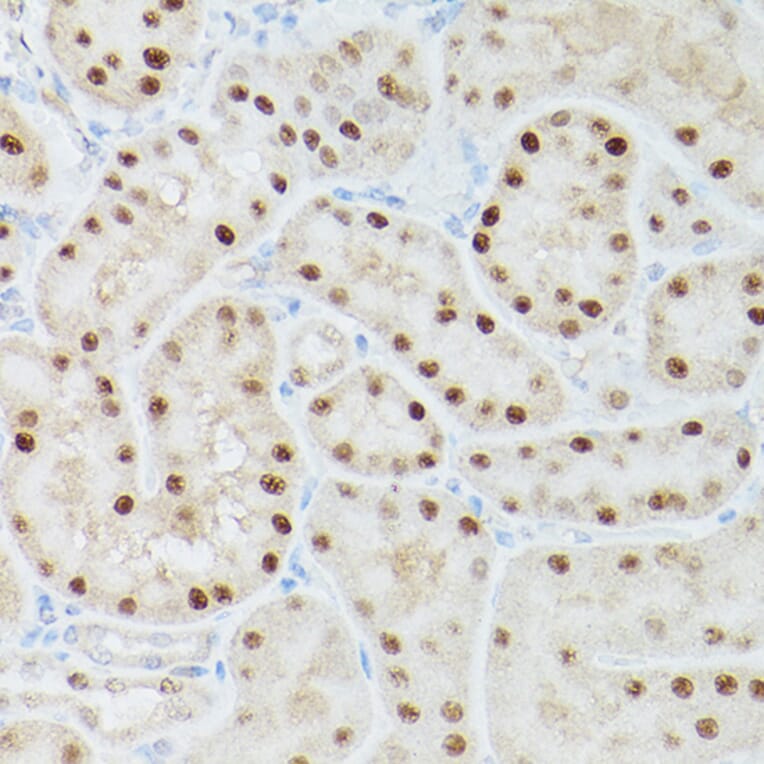 Immunohistochemistry - Anti-ADK Antibody (A89787) - Antibodies.com