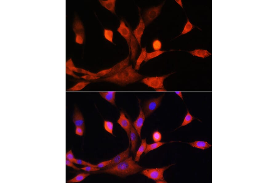 Immunofluorescence - Anti-ADK Antibody (A89787) - Antibodies.com