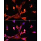 Immunofluorescence - Anti-ADK Antibody (A89787) - Antibodies.com