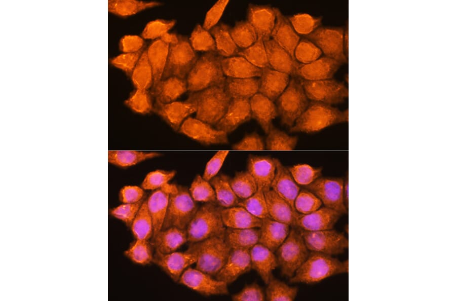 Immunofluorescence - Anti-ADK Antibody (A89787) - Antibodies.com