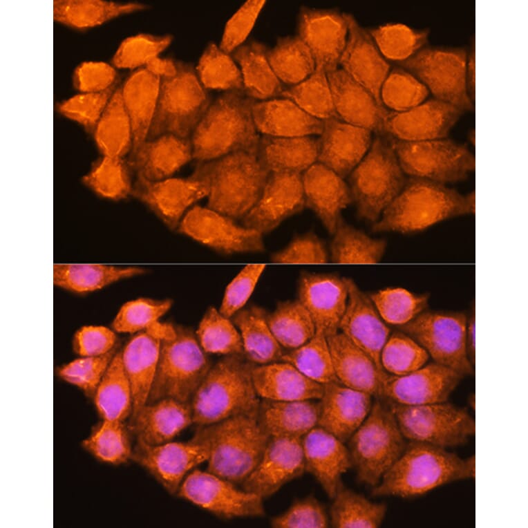 Immunofluorescence - Anti-ADK Antibody (A89787) - Antibodies.com