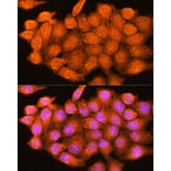 Immunofluorescence - Anti-ADK Antibody (A89787) - Antibodies.com