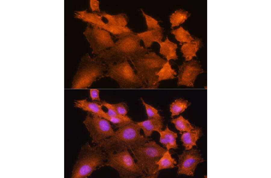 Immunofluorescence - Anti-ADK Antibody (A89787) - Antibodies.com