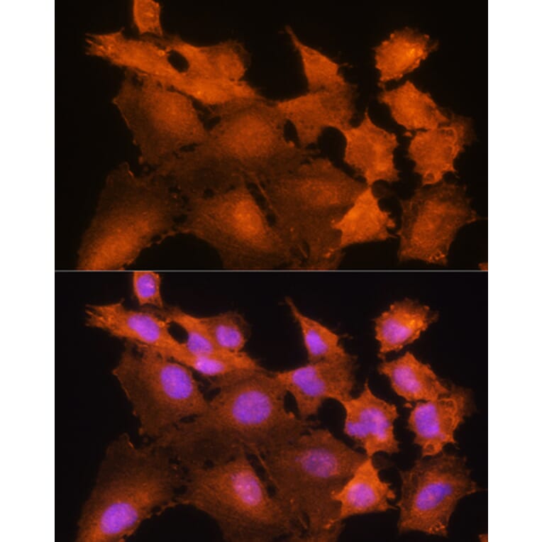 Immunofluorescence - Anti-ADK Antibody (A89787) - Antibodies.com
