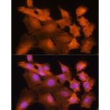 Immunofluorescence - Anti-ADK Antibody (A89787) - Antibodies.com