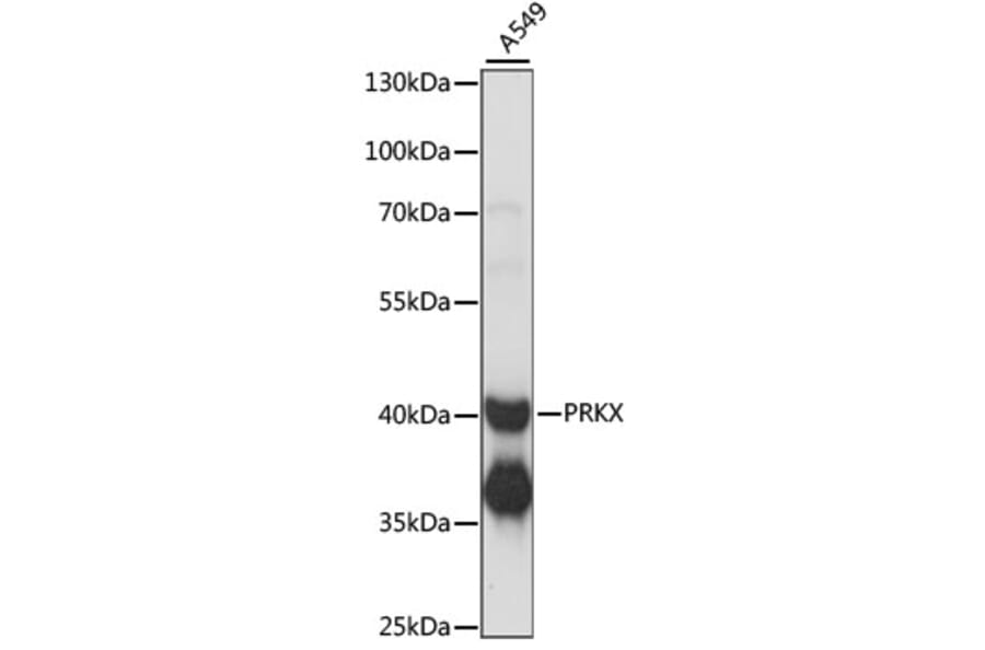 Western Blot - Anti-PRKX Antibody (A89788) - Antibodies.com