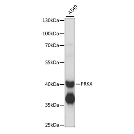 Western Blot - Anti-PRKX Antibody (A89788) - Antibodies.com