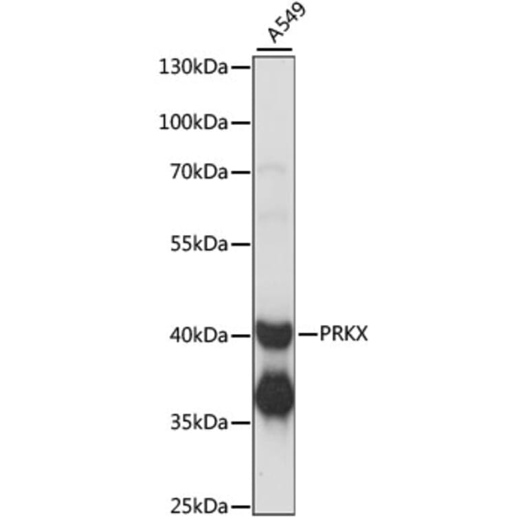 Western Blot - Anti-PRKX Antibody (A89788) - Antibodies.com