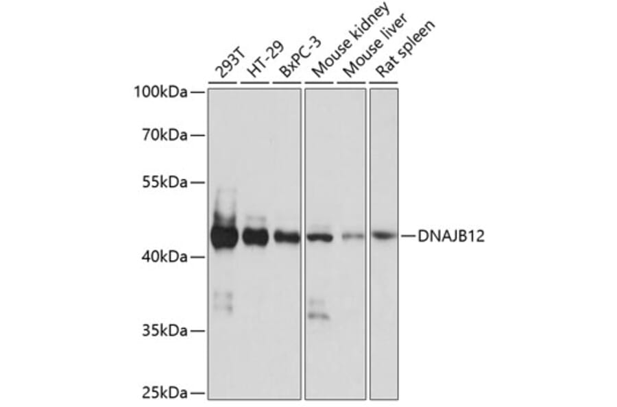 Western Blot - Anti-DNAJB12 Antibody (A89789) - Antibodies.com