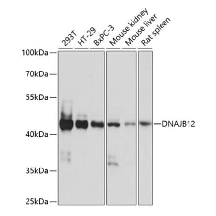 Western Blot - Anti-DNAJB12 Antibody (A89789) - Antibodies.com