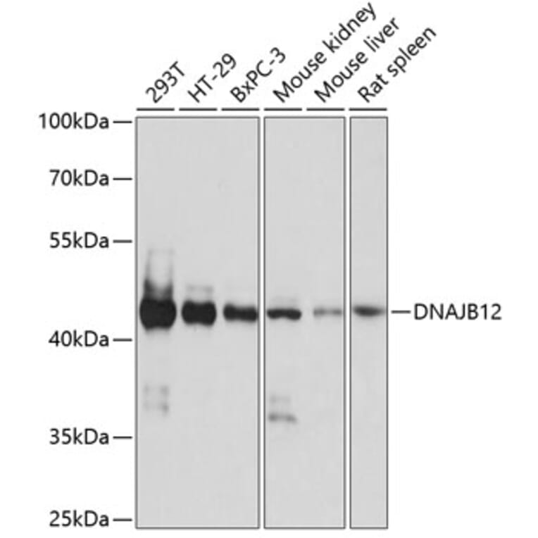 Western Blot - Anti-DNAJB12 Antibody (A89789) - Antibodies.com