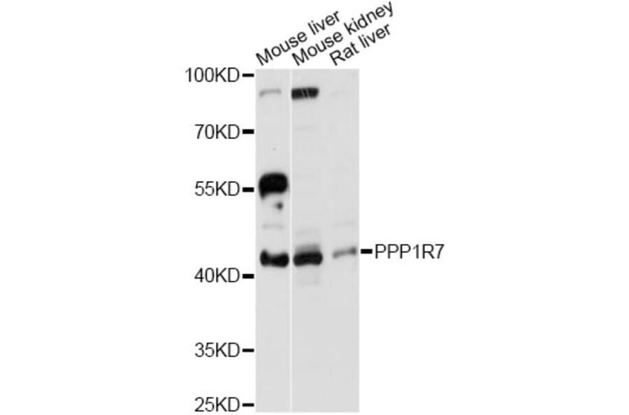 Western Blot - Anti-PPP1R7 Antibody (A13040) - Antibodies.com