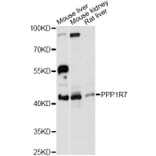 Western Blot - Anti-PPP1R7 Antibody (A13040) - Antibodies.com