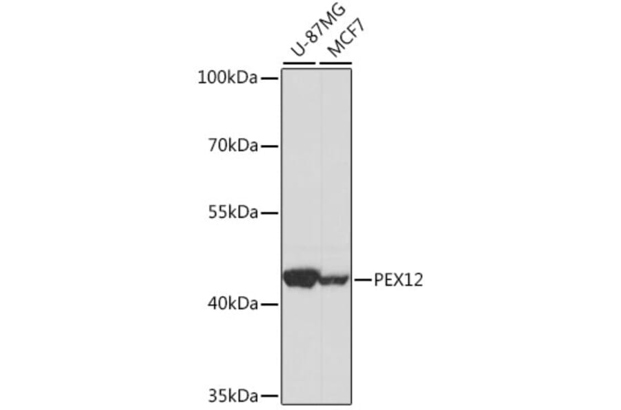 Western Blot - Anti-PEX12 Antibody (A89791) - Antibodies.com