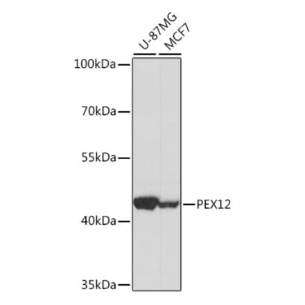 Western Blot - Anti-PEX12 Antibody (A89791) - Antibodies.com