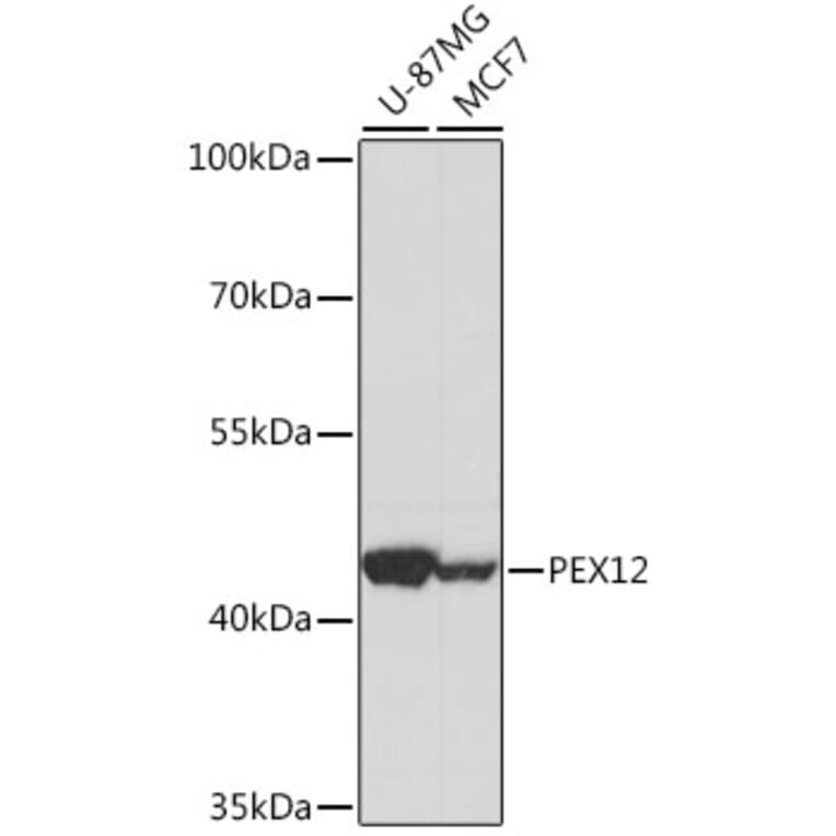 Western Blot - Anti-PEX12 Antibody (A89791) - Antibodies.com