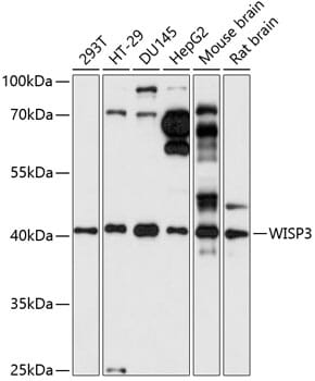 Western blot analysis of extracts of various cell lines, using Anti-WISP3 Antibody (A14812) at 1:1,000 dilution.
Secondary antibody: Goat Anti-Rabbit IgG (H+L) (HRP) (AS014) at 1:10,000 dilution.
Lysates / proteins: 25µg per lane.
Blocking buffer: 3% non-fat dry milk in TBST.
Detection: ECL Basic Kit (RM00020).
Exposure time: 30s.