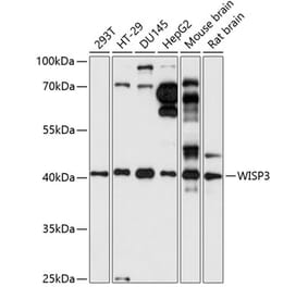 Western Blot - Anti-WISP3 Antibody (A89792) - Antibodies.com