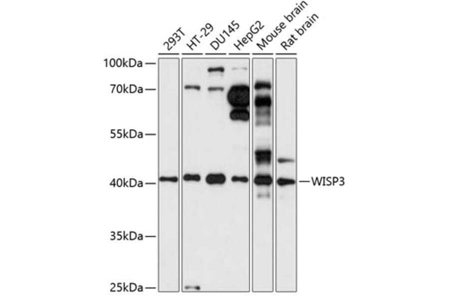 Western Blot - Anti-WISP3 Antibody (A89792) - Antibodies.com