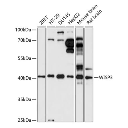 Western Blot - Anti-WISP3 Antibody (A89792) - Antibodies.com