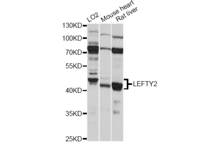 Western Blot - Anti-LEFTY2 Antibody (A14065) - Antibodies.com