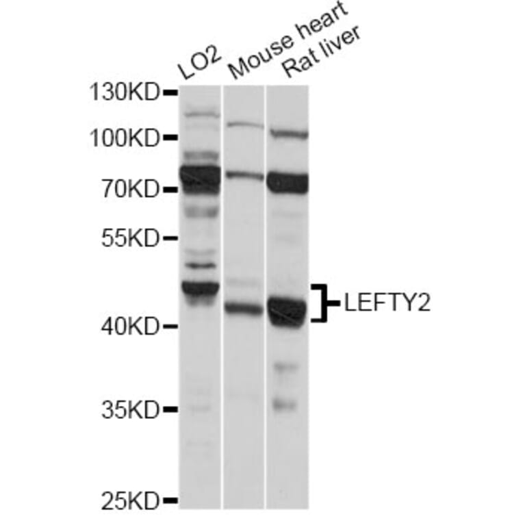 Western Blot - Anti-LEFTY2 Antibody (A14065) - Antibodies.com