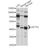 Western Blot - Anti-LEFTY2 Antibody (A14065) - Antibodies.com