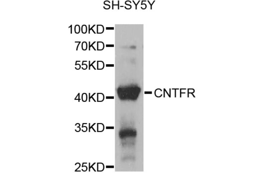 Western Blot - Anti-CNTFR Antibody (A12424) - Antibodies.com