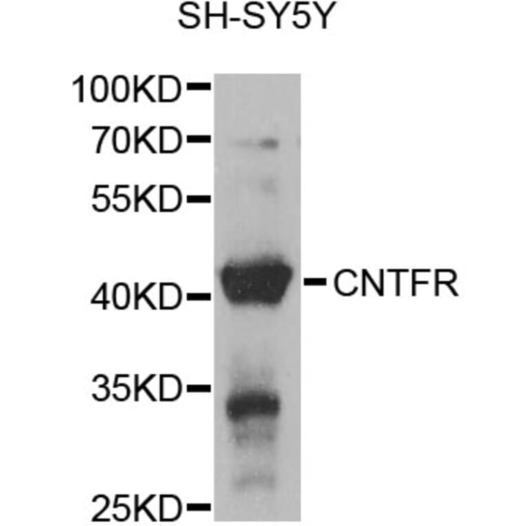 Western Blot - Anti-CNTFR Antibody (A12424) - Antibodies.com