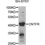 Western Blot - Anti-CNTFR Antibody (A12424) - Antibodies.com