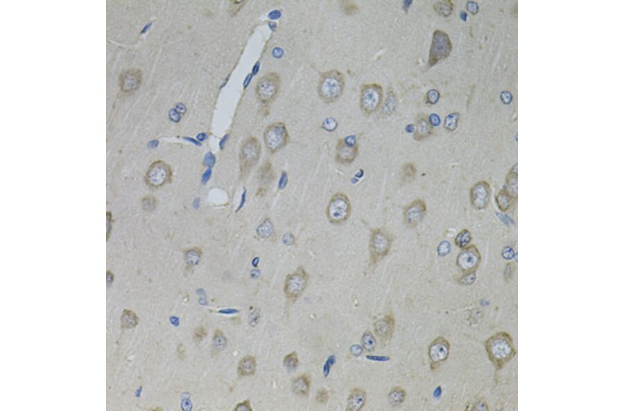 Immunohistochemistry - Anti-CNTFR Antibody (A12424) - Antibodies.com