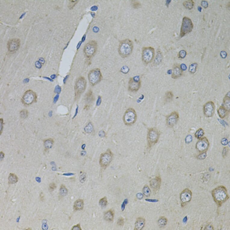 Immunohistochemistry - Anti-CNTFR Antibody (A12424) - Antibodies.com