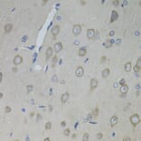 Immunohistochemistry - Anti-CNTFR Antibody (A12424) - Antibodies.com