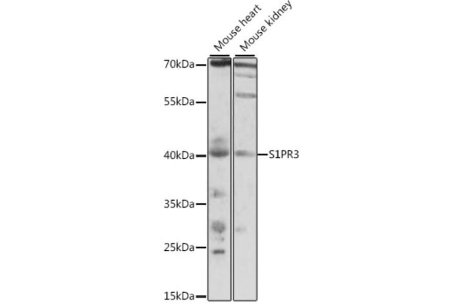 Western Blot - Anti-EDG3/S1P3 Antibody (A89795) - Antibodies.com