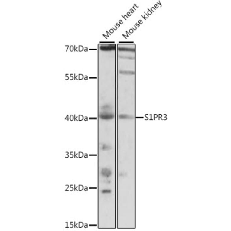 Western Blot - Anti-EDG3/S1P3 Antibody (A89795) - Antibodies.com