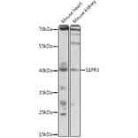 Western Blot - Anti-EDG3/S1P3 Antibody (A89795) - Antibodies.com