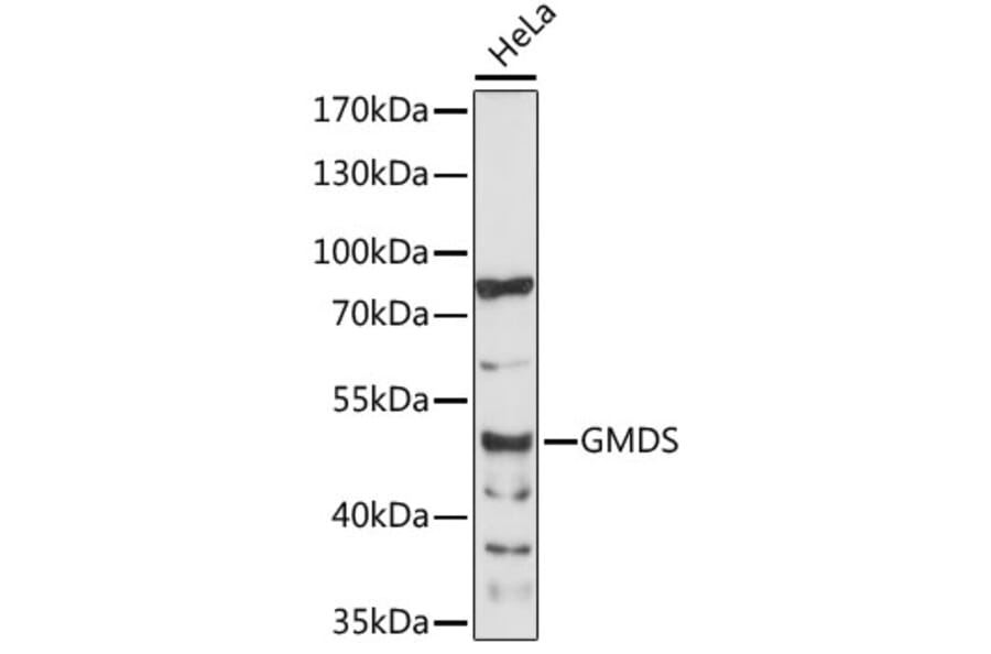 Western Blot - Anti-GMDS Antibody (A89796) - Antibodies.com