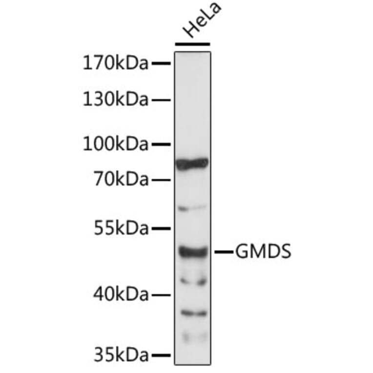 Western Blot - Anti-GMDS Antibody (A89796) - Antibodies.com