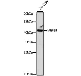 Western Blot - Anti-MEF2B Antibody (A89797) - Antibodies.com